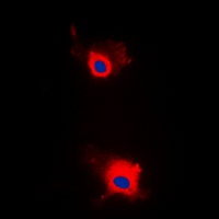 IRS1 (Phospho-S636) Rabbit Polyclonal Antibody