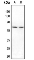 IRX3 Rabbit Polyclonal Antibody