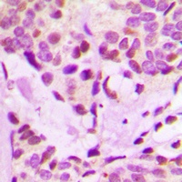 IRX3 Rabbit Polyclonal Antibody