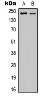 VEGFR2 (Phospho-Y1175) Rabbit Polyclonal Antibody