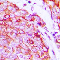 VEGFR2 (Phospho-Y1175) Rabbit Polyclonal Antibody