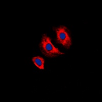 VEGFR2 (Phospho-Y1175) Rabbit Polyclonal Antibody