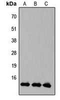 KLF10/11 Rabbit Polyclonal Antibody