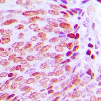 KLF10/11 Rabbit Polyclonal Antibody