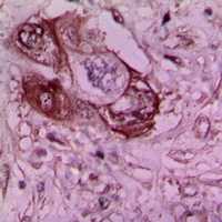 Laminin gamma 1 Rabbit Polyclonal Antibody