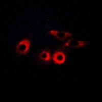 Laminin gamma 1 Rabbit Polyclonal Antibody