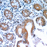 LIF Rabbit Polyclonal Antibody
