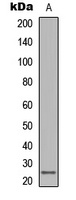 LT beta Rabbit Polyclonal Antibody