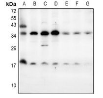 LY6E Rabbit Polyclonal Antibody