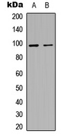 MACC1 Rabbit Polyclonal Antibody
