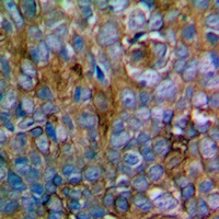 MKK1/2 Rabbit Polyclonal Antibody