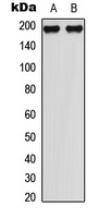 MEKK1 (Phospho-T1402) Rabbit Polyclonal Antibody