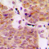 MEKK1 (Phospho-T1402) Rabbit Polyclonal Antibody