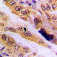 JNK2 Rabbit Polyclonal Antibody