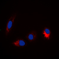 TAU (Phospho-S673) Rabbit Polyclonal Antibody