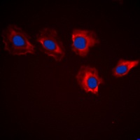 MARK3 Rabbit Polyclonal Antibody
