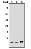 MED11 Rabbit Polyclonal Antibody