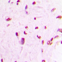 MEF2C Rabbit Polyclonal Antibody