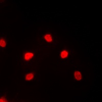MEF2C Rabbit Polyclonal Antibody