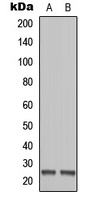MOB1B Rabbit Polyclonal Antibody