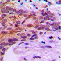 MOB1B Rabbit Polyclonal Antibody