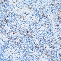 Myeloperoxidase Rabbit Polyclonal Antibody