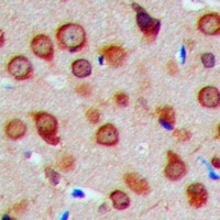 MRPS5 Rabbit Polyclonal Antibody