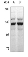 MSH3 Rabbit Polyclonal Antibody