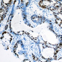 MSH3 Rabbit Polyclonal Antibody