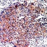 MUC1 Rabbit Polyclonal Antibody