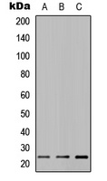 MUC16 Rabbit Polyclonal Antibody