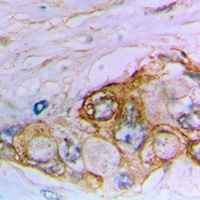 MUC16 Rabbit Polyclonal Antibody