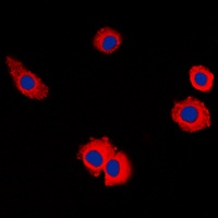 MUC16 Rabbit Polyclonal Antibody