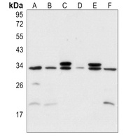 MYF5 Rabbit Polyclonal Antibody