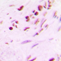 MYF5 Rabbit Polyclonal Antibody