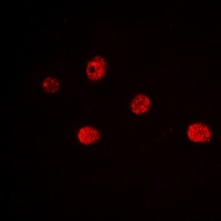 MYF5 Rabbit Polyclonal Antibody