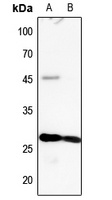 MYL3 Rabbit Polyclonal Antibody
