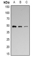 p47 phox (Phospho-S328) Rabbit Polyclonal Antibody