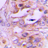 NDRG2 Rabbit Polyclonal Antibody