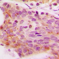 NFAT4 (Phospho-S165) Rabbit Polyclonal Antibody