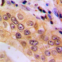 NFAT3 (Phospho-S676) Rabbit Polyclonal Antibody