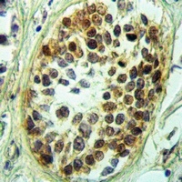 NFIL3 Rabbit Polyclonal Antibody