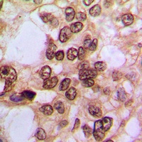 NF-kappaB p105/p50 (Phospho-S337) Rabbit Polyclonal Antibody