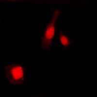 NF-kappaB p105/p50 (Phospho-S337) Rabbit Polyclonal Antibody