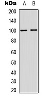 NF-kappaB p100 (Phospho-S865) Rabbit Polyclonal Antibody