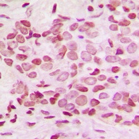 NF-kappaB p100 (Phospho-S865) Rabbit Polyclonal Antibody