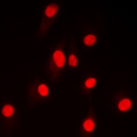 NF-kappaB p100 (Phospho-S865) Rabbit Polyclonal Antibody