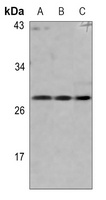 pro-NGF beta Rabbit Polyclonal Antibody