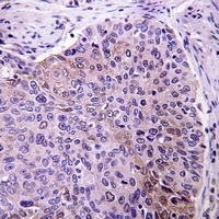 pro-NGF beta Rabbit Polyclonal Antibody