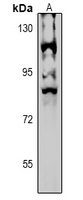 NPAS4 Rabbit Polyclonal Antibody